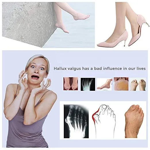 Bunion Splint Corrector Big Toe Straightener Brace Pad Blue & White