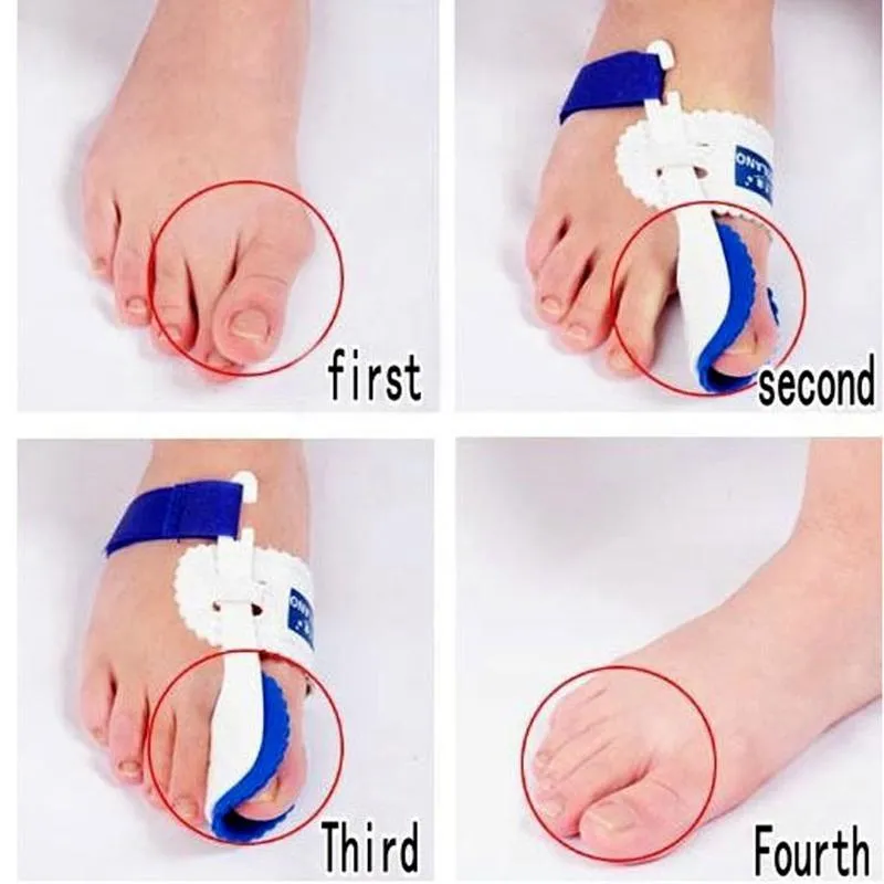 Bunion Splint Corrector Big Toe Straightener Brace Pad Blue & White
